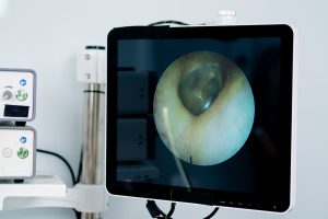 qué es una endoscopia